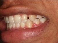 Konig Center for Cosmetic & Comprehensive Dentistry smile photos